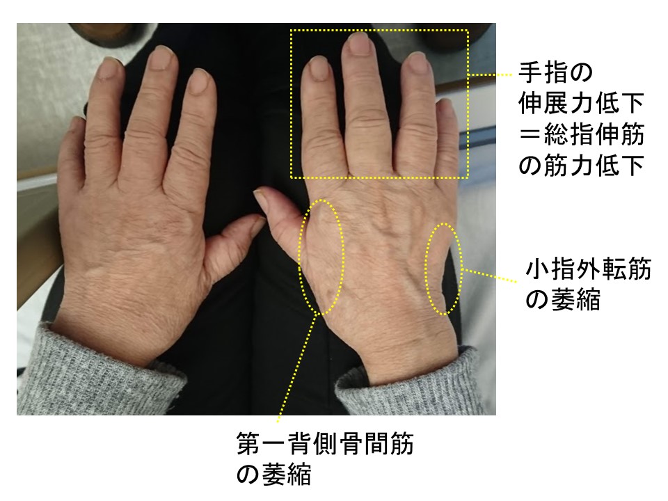 しびれる話 となりの堤